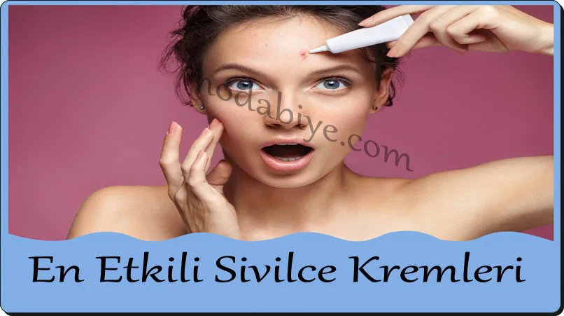 En Etkili Sivilce Kremleri