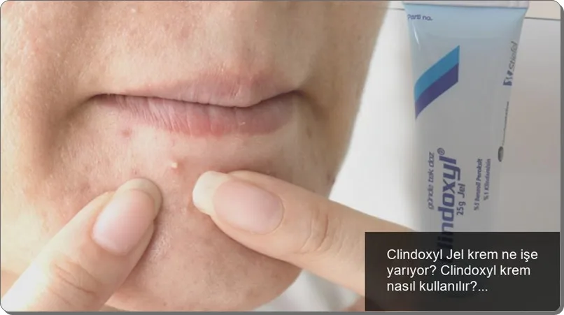 Clindoxyl Jel Krem Ne İşe Yarar? 