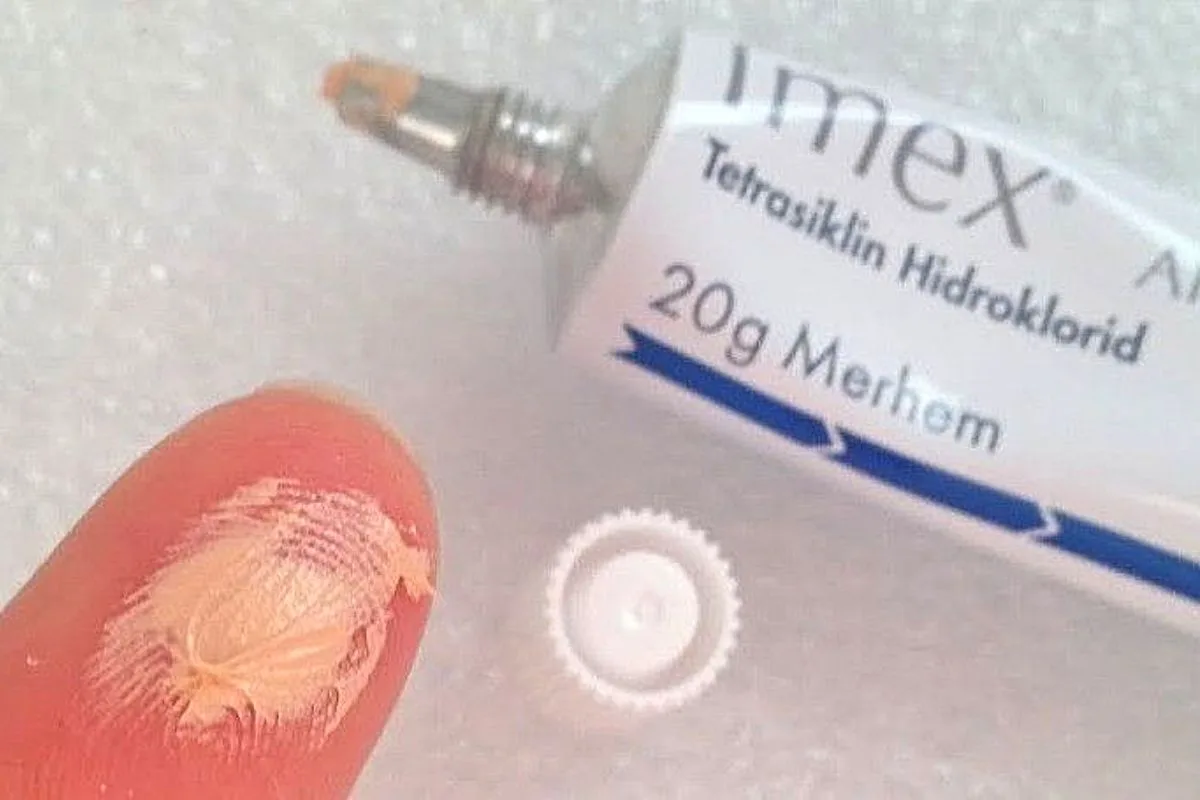 İmex krem nedir? Ne işe yarar?