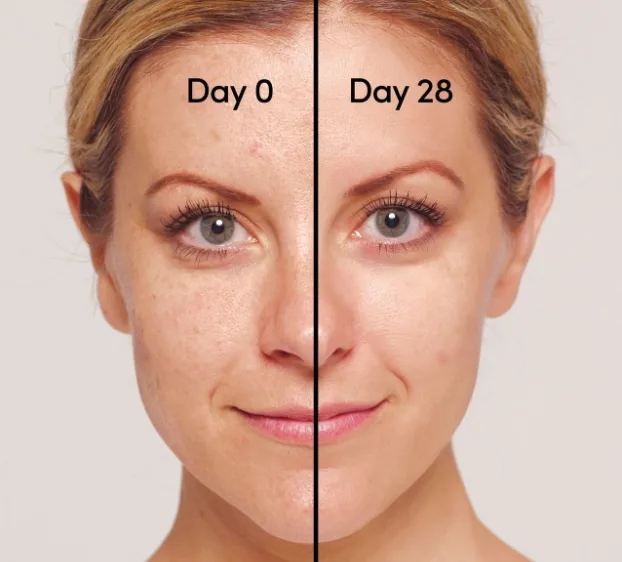 retinol goz kirisikligi krem oncesi sonrasi
