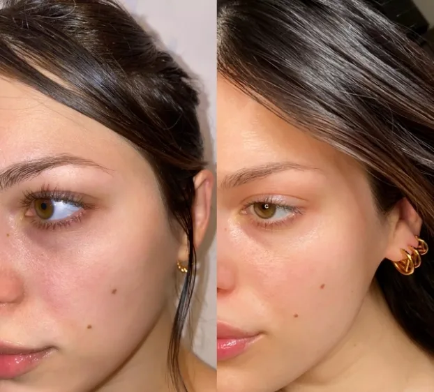 retinol goz kremi oncesi ve sonrasi